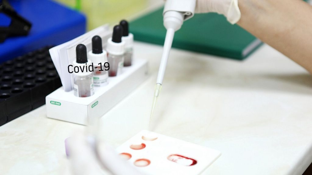 coronavirus vaccine testing